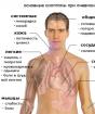 Vad är lunginflammation och hur behandlas det?