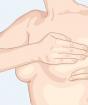 Nodular mastopathy ng mammary gland Fibroadenoma ng mammary gland