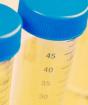 Laboratoorsed testid neerude ja kuseteede funktsiooni hindamiseks - uriinianalüüs Nechiporenko järgi: mida see näitab ja kuidas koguda